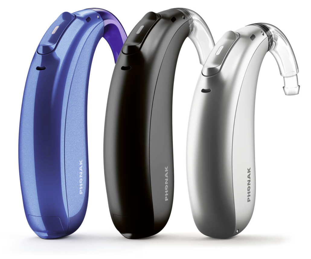 Pérdida Severa-Profunda