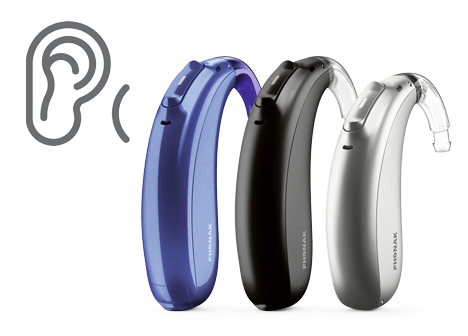 Pérdida Severa-Profunda